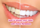 How to Whiten your Teeth with Home Remedies