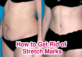 6 Secrets How to Get Rid of Stretch Marks Instantly
