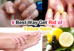 5 Best Way How to Get Rid of Yellow Nails Quick