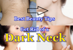 Are you worried about your black or dark neck 2023/ 2024 ? and looking for skin beauty tips on how to get rid of a dark or black neck. Here we guide you best tips & solutions.