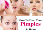 How To Treat Your Pimples at Home 2023/ 2024
