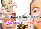 Top 5 Best Home Remedies for Oily Skin & Pimples 2023/ 2024