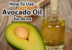 Avocado oil is a true all-rounder for your skin, acne, and hair 2023/ 2024. Not only is that why avocado oil is contained in many cosmetic products. It has an anti-inflammatory effect, so pimples hardly have a chance.